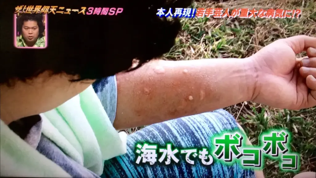 手が腫れている